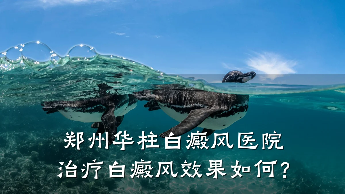 郑州华柱白癜风医院治疗白癜风效果如何?